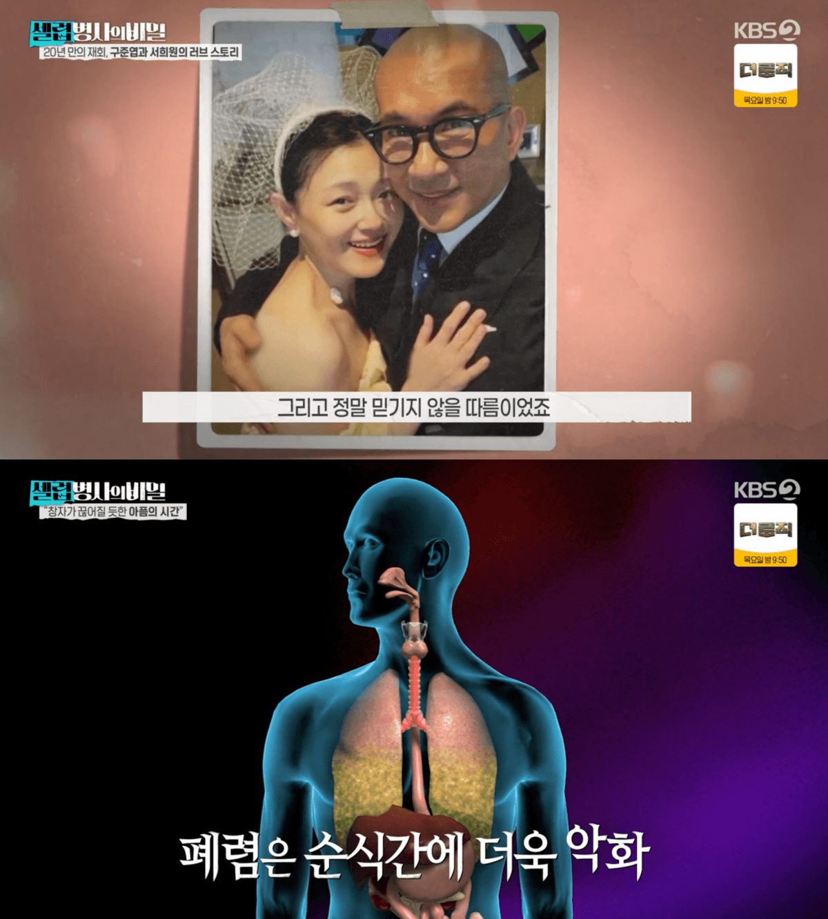 Why Did Barbie Hsu Die So Suddenly? The Shocking Medical Truth Revealed on KBS Special
